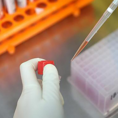 Kit de prueba de viruela del mono PCR en tiempo real para enfermedades infecciosas MPXV CE registrado 1 prueba/caja