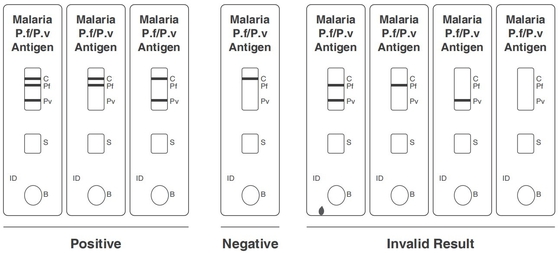 CE rápido de Kit Colloidal Gold de la prueba del antígeno de la malaria PF/PV registrado